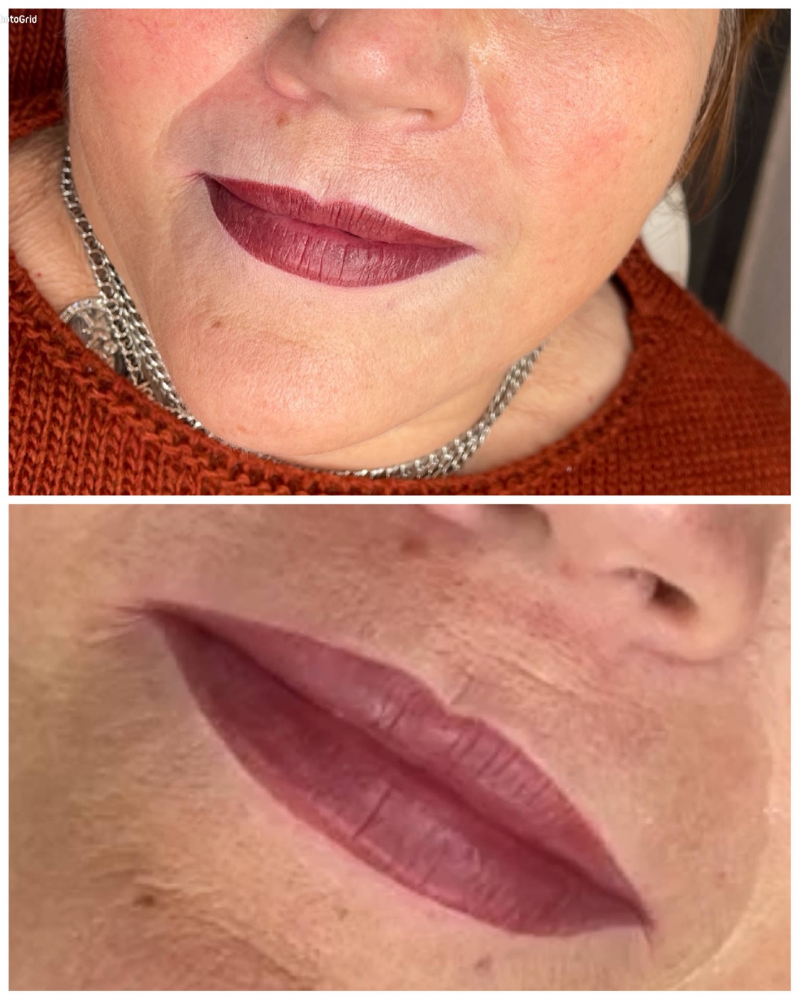 Lippenpigmentierung bei NF Beauty